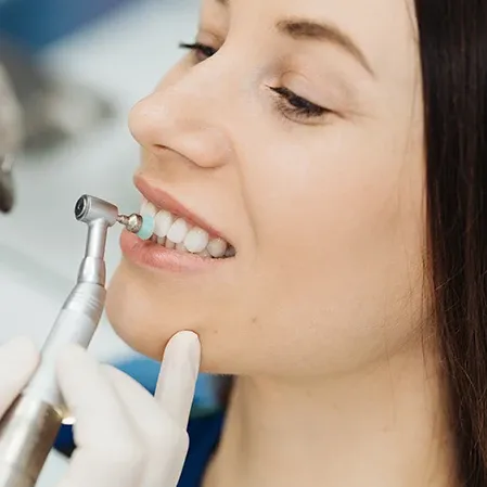 A dentist polishing a patient's teeth