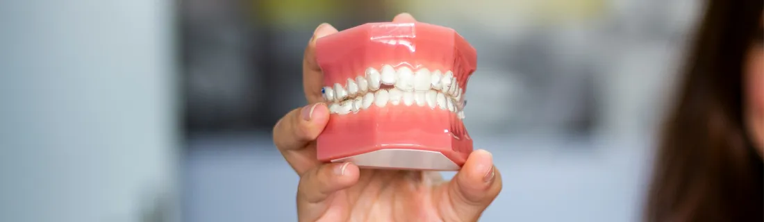 FC – Dentures at Dr. Leo Christensen – Tooth Carpenter in Coalville UT